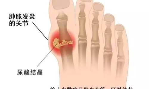 祖卡木颗粒糖尿病人可以吃吗-祖卡木颗粒 无糖型 说明书网- 祖卡木颗粒的用法用量知识,分享祖卡木颗粒糖尿病人可以吃吗