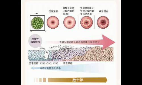 祖卡木颗粒糖尿病人可以吃吗-祖卡木颗粒 无糖型 说明书网- 祖卡木颗粒的用法用量知识,分享祖卡木颗粒糖尿病人可以吃吗